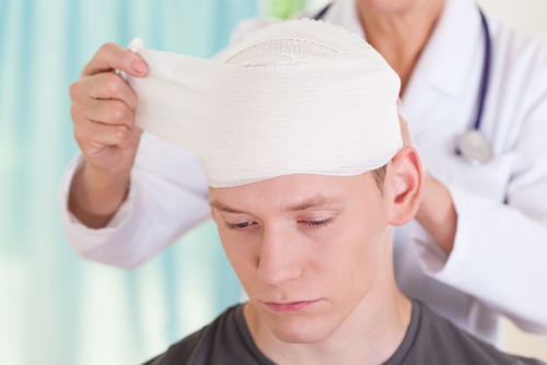 concussion recovery